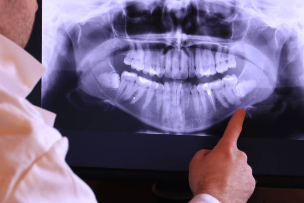 Best Broken or Cracked Tooth Emergency Dentist in Berly, MO