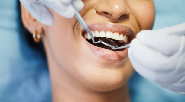 Best Emergency Dental Extractions in Berly, MO