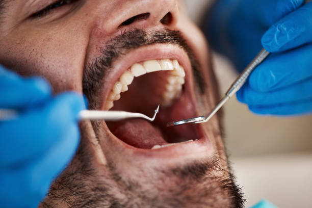 Best Emergency Dental Extractions in Berly, MO